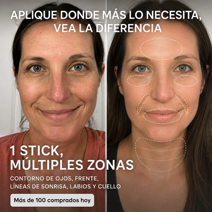 Eloria – Stick Repulpante PDRN con Colágeno
