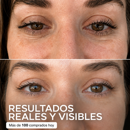 Eloria – Stick Repulpante PDRN con Colágeno